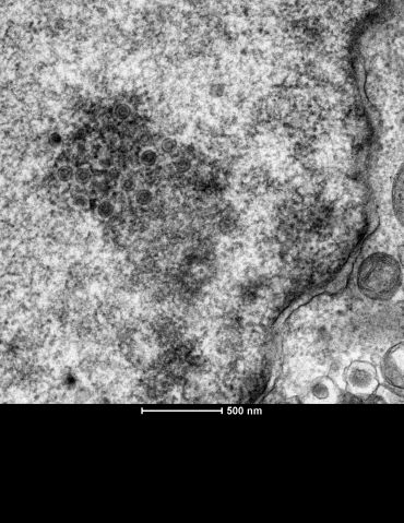 Viral particles – seen as circular and squiggle-like shapes – inside a human cell.